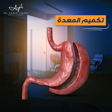 Slider image (5) Dr. Ahmed Yousry Clinic